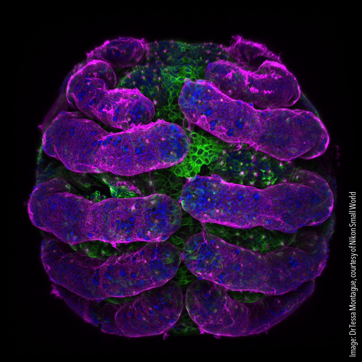5-spider embryo Parasteatoda tepidariorum (spider embryo) stained for embryo surface (pink), nuclei (blue) and microtubules (green). Confocal 20x (objective lens magnification)